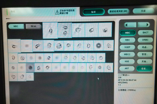 美國IQ 樣本測試圖 白細胞